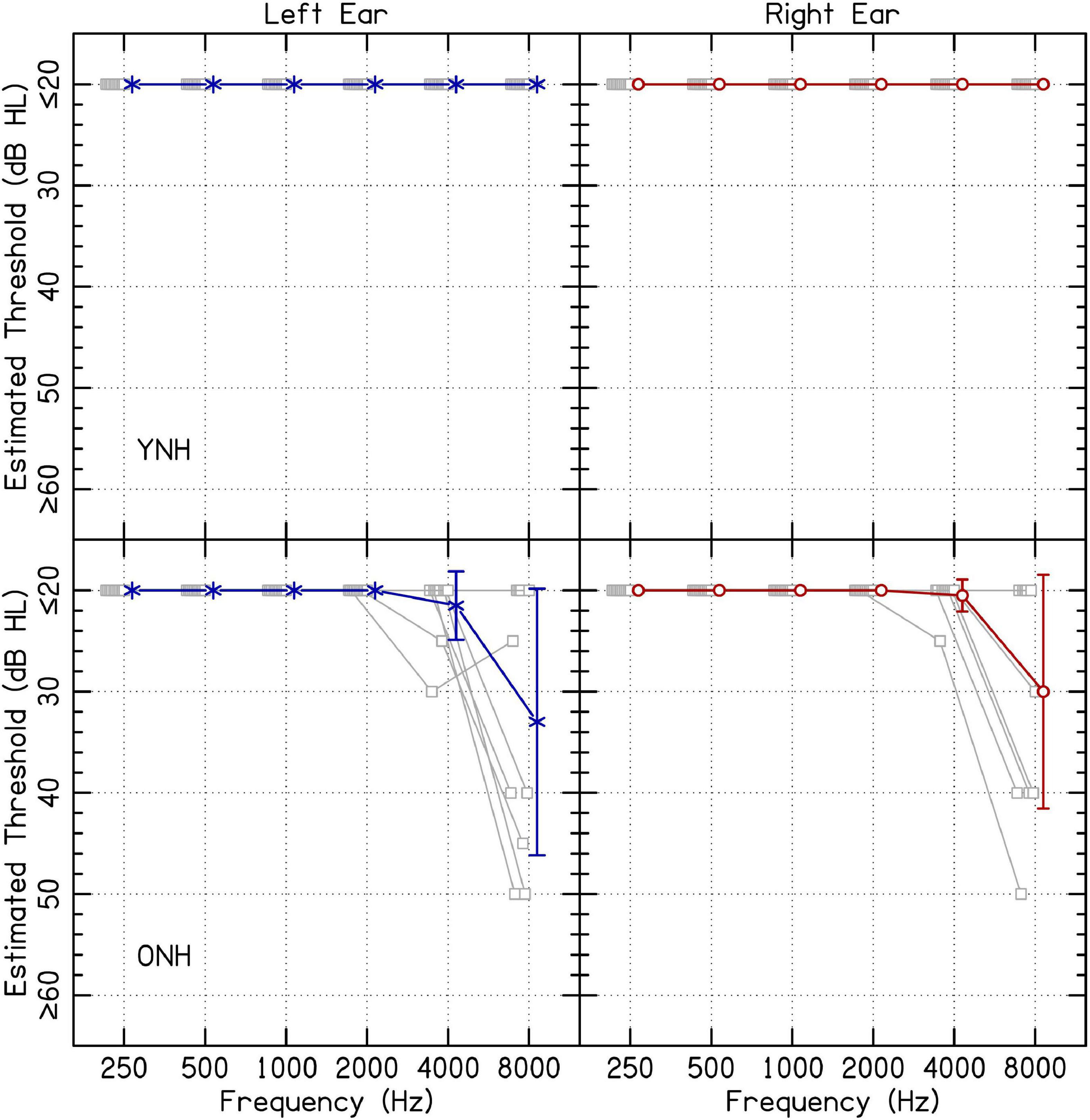 Interaural asymmetry of dynamic range: Abnormal fusion, bilateral interference, and shifts in attention